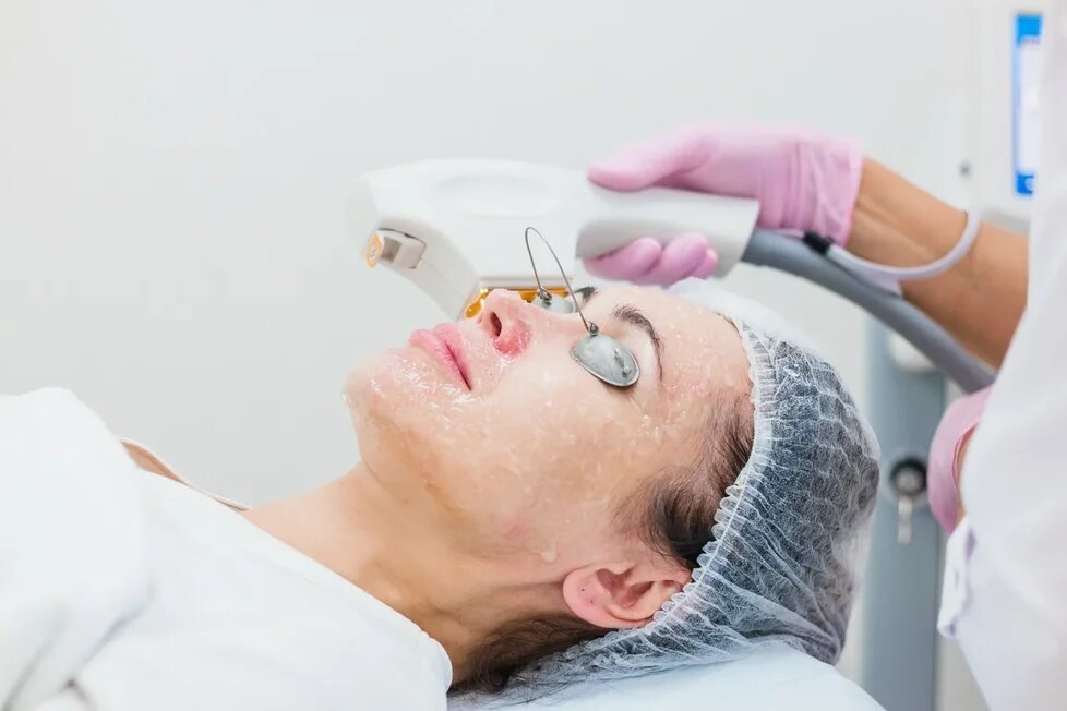 Фототерапия BBL эффективно борется с последствиями негативного воздействия солнца