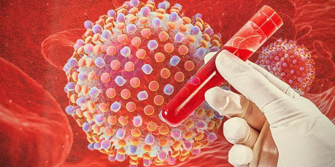 Вы в группе риска? Почему гепатит — уже не болезнь маргиналов, а угроза для каждого