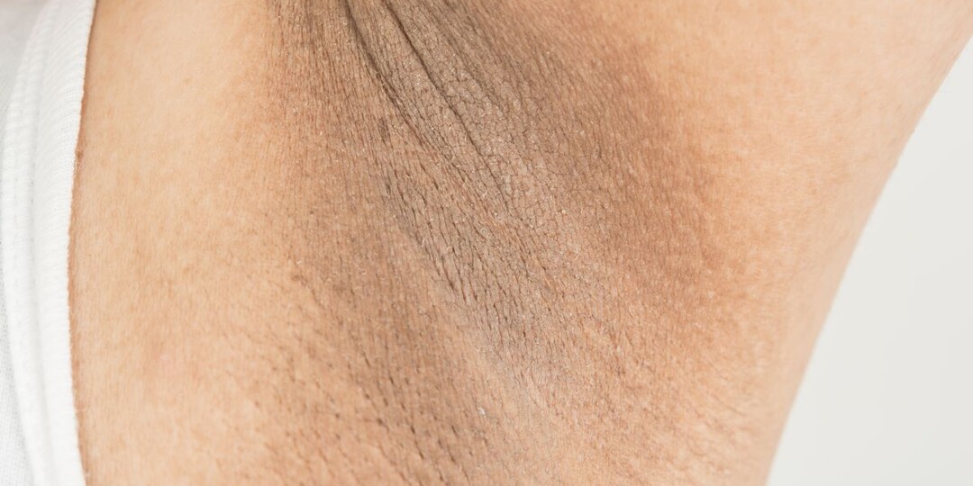 Кожа начала темнеть в складках — что часто находят в анализах