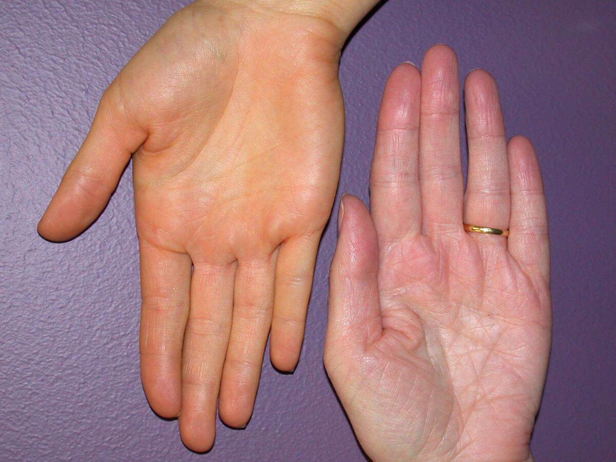 Желтоватый оттенок кожи: на что это может указывать