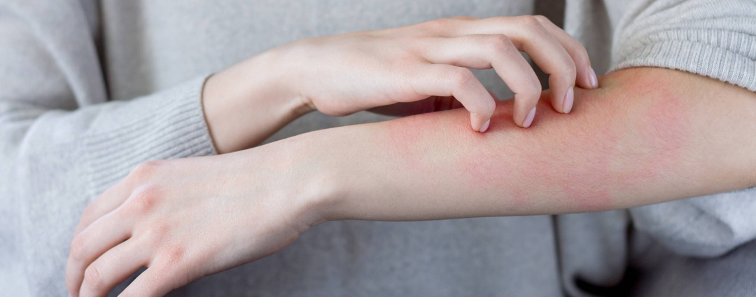 Кожа и психика: почему проблемы на поверхности часто идут изнутри