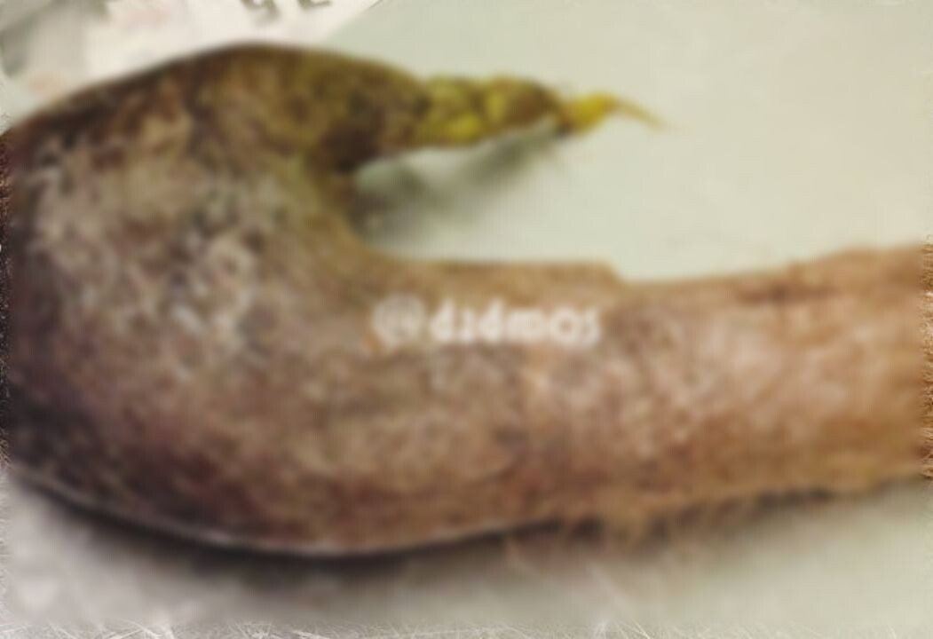     / Источник: Департамент здравоохранения Москвы