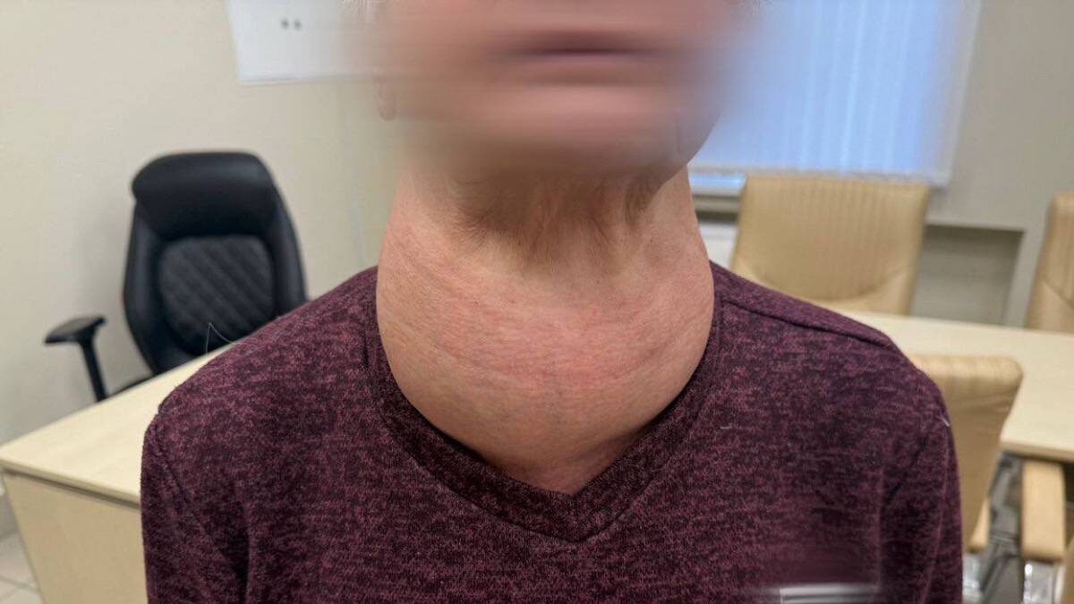    Фото: Telegram / Наша РКБ