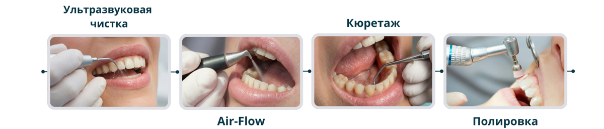 Этапы профгигиены для наглядности