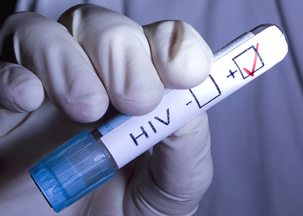    В Чехии рекордный рост заболеваемости ВИЧ, который увязывают с эпидемией ковида и конфликтом на Украине