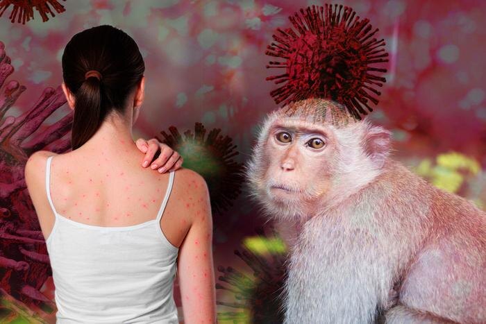 Оспа обезьян в России — что известно. Обложка © Коллаж © Life.ru, фото © Shutterstock / FOTODOM / Fahroni, New Africa