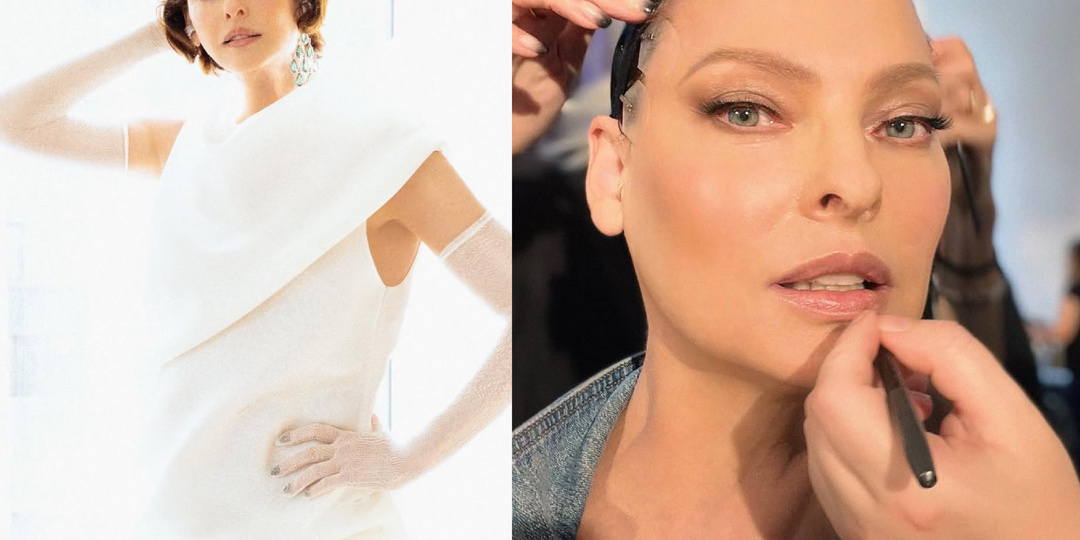 Эти звёзды ЗАПЛАТИЛИ за ошибку после пластической операции