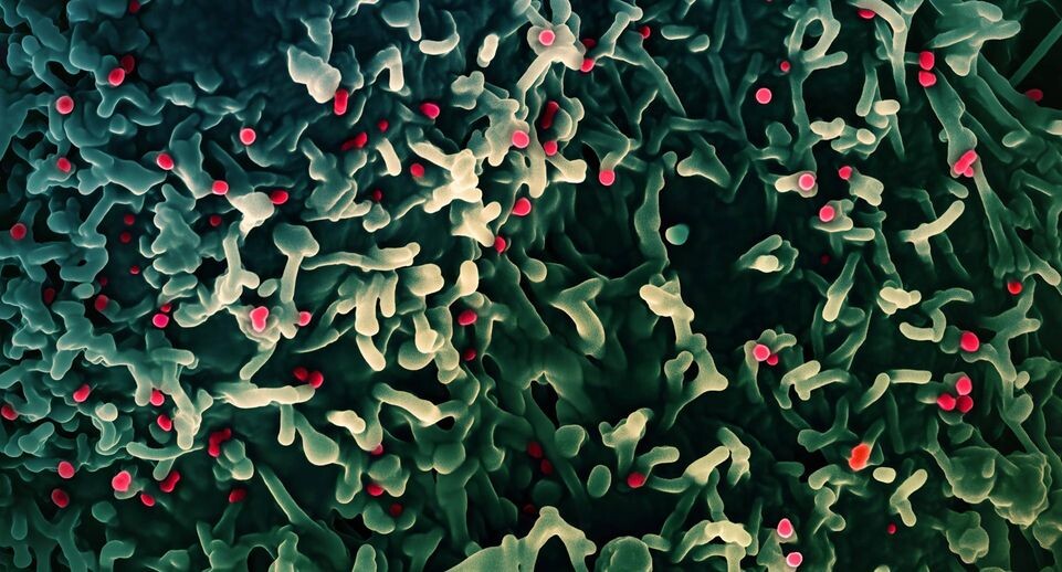    IMAGO/NIH-NIAID / IMAGE POINT FR / www.globallookpress.com