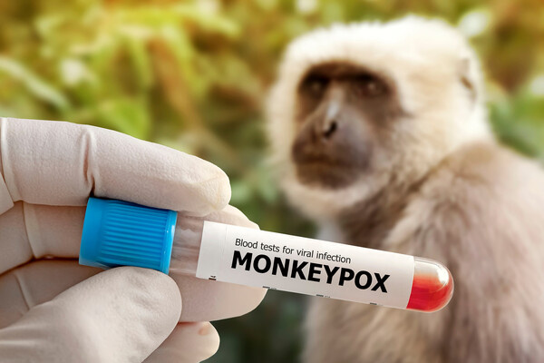 Shutterstock  