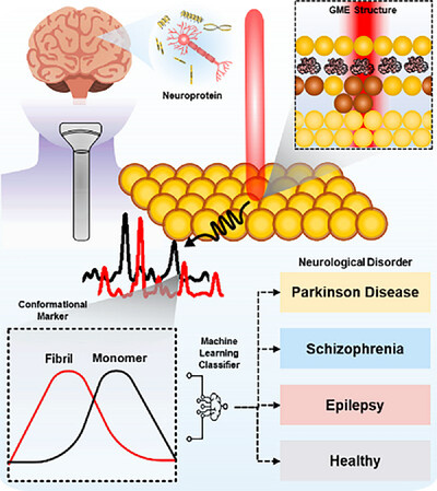 Схема диагностики неврологических расстройств на основе слюны [Предоставлено Корейским институтом материаловедения]