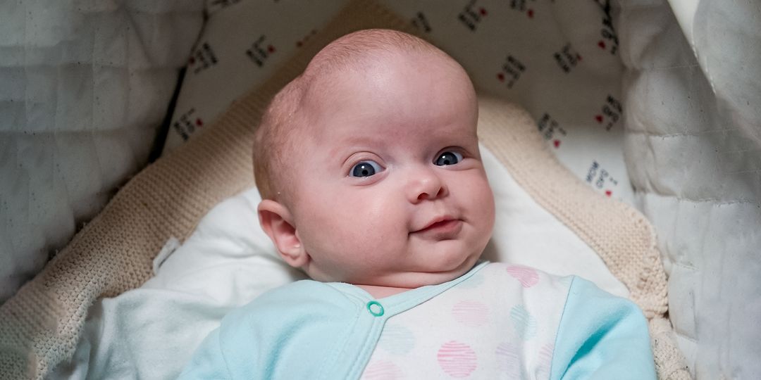 Череп малышки сросся в утробе матери. Только операция спасет ее от слепоты и эпилепсии.