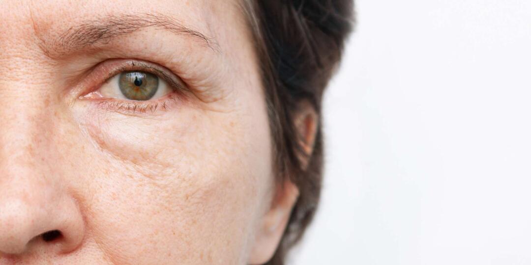 Отёки под глазами + сухая кожа — какую железу проверяют