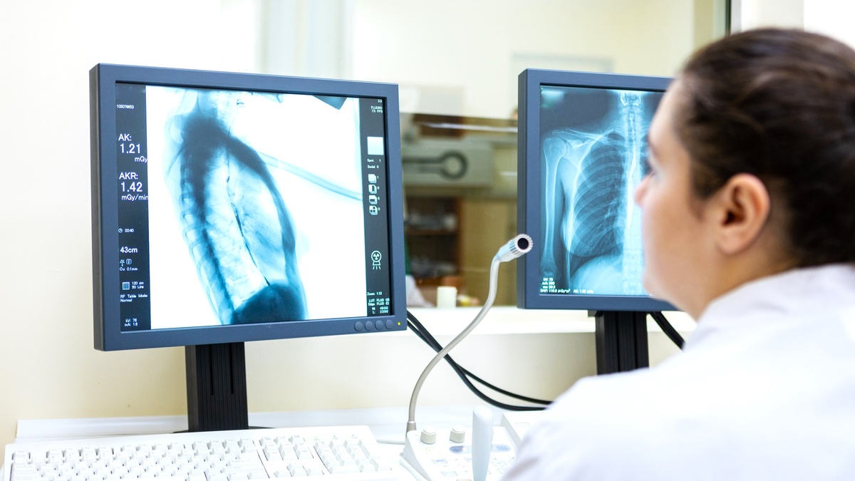    Более 42 тысяч югорчан состоят на учёте у онкологов