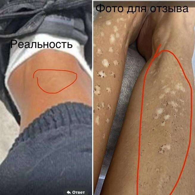 Версия ProfLaser, что клиентка скорректировала фото. Источник: NGS.RU