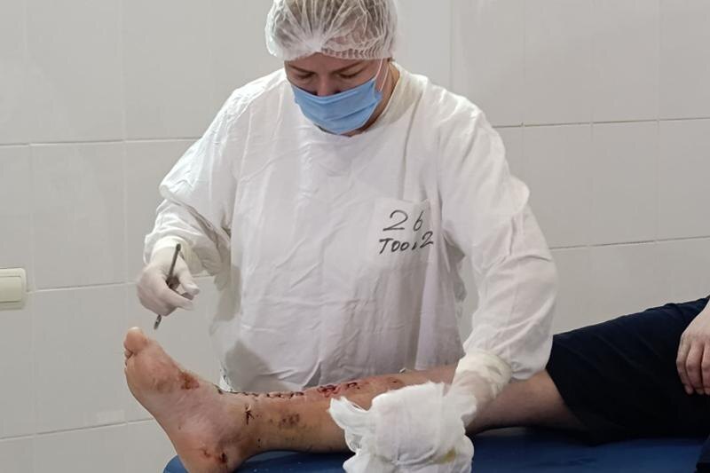    Минздрав. Травмированная нога после падения с крыши