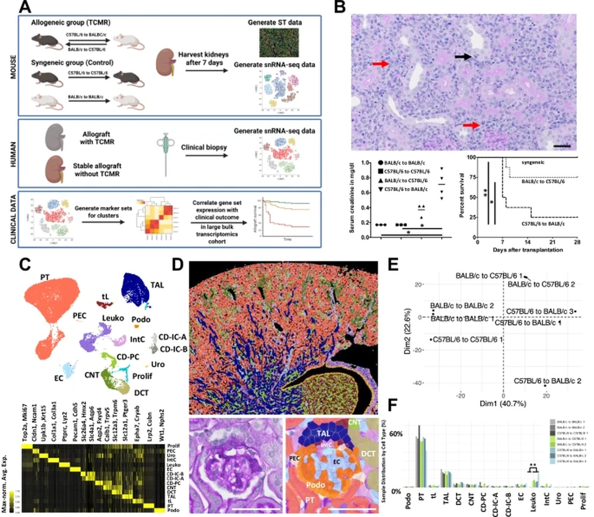    Аллогенная трансплантация почки мыши вызывает T-клеточное отторжение и связана с повышенной смертностью. Схематический обзор, показывающий общий план исследования, включая образцы мышей и людей.