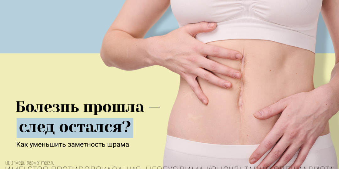 Можно ли сделать менее заметным шрам после заболеваний кожи?