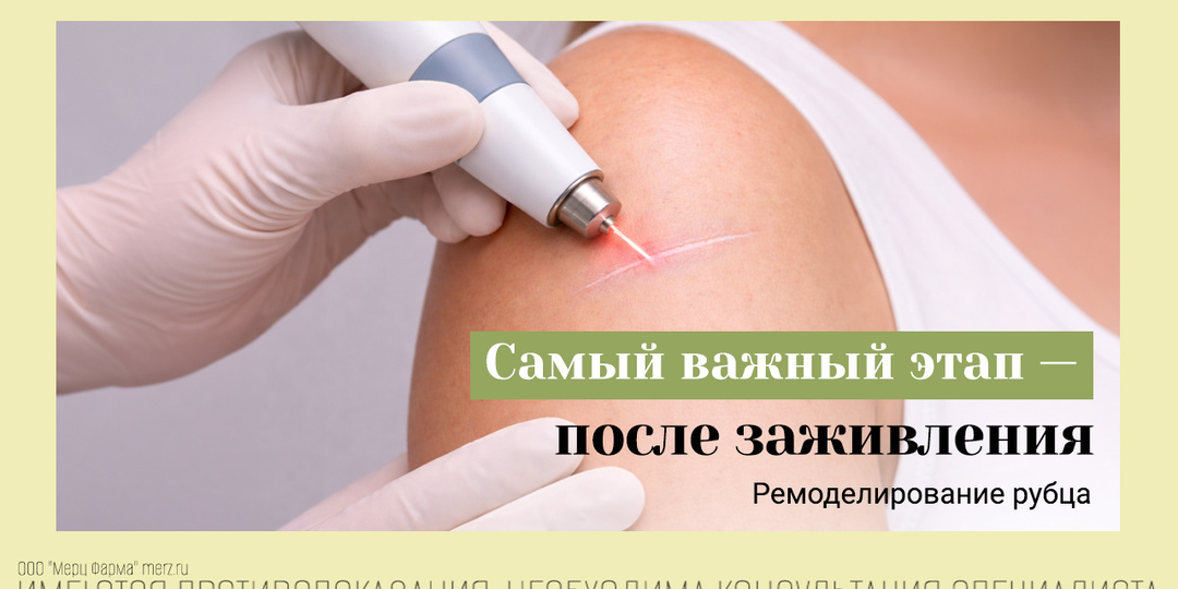 Что такое фаза ремоделирования: что происходит на завершающем этапе формирования шрама?