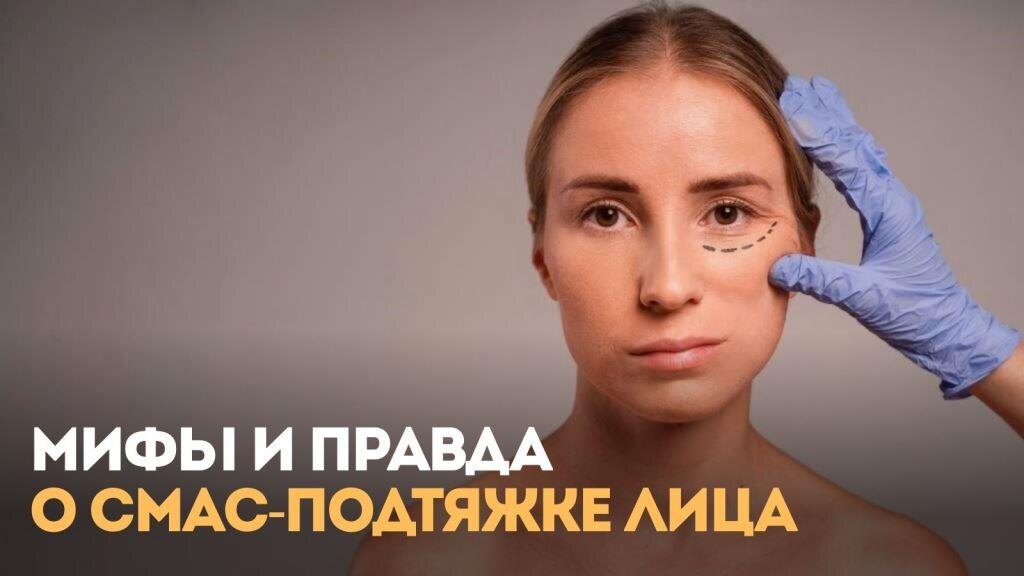 Мифы и правда о СМАС-подтяжке лица 