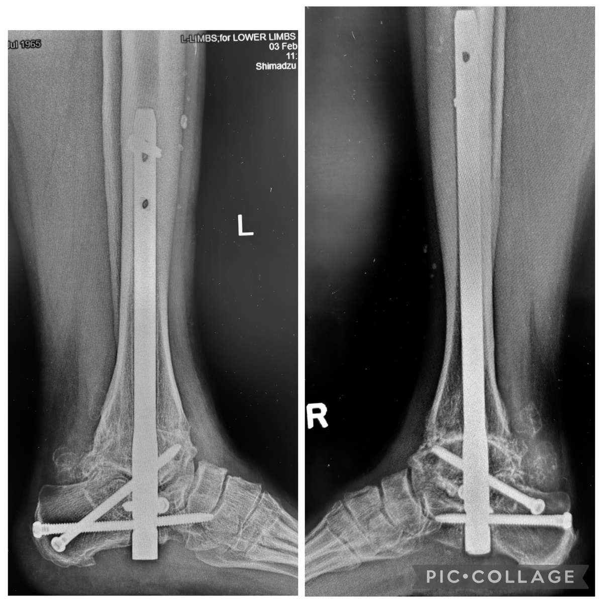 Это вид сбоку