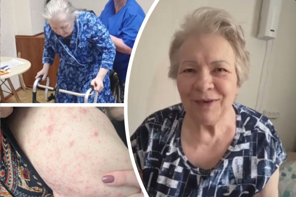 Пенсионерка Татьяна покрылась сыпью и исхудала за месяц в другом пансионате. Фото: Предоставлены Еленой Аксеновой.