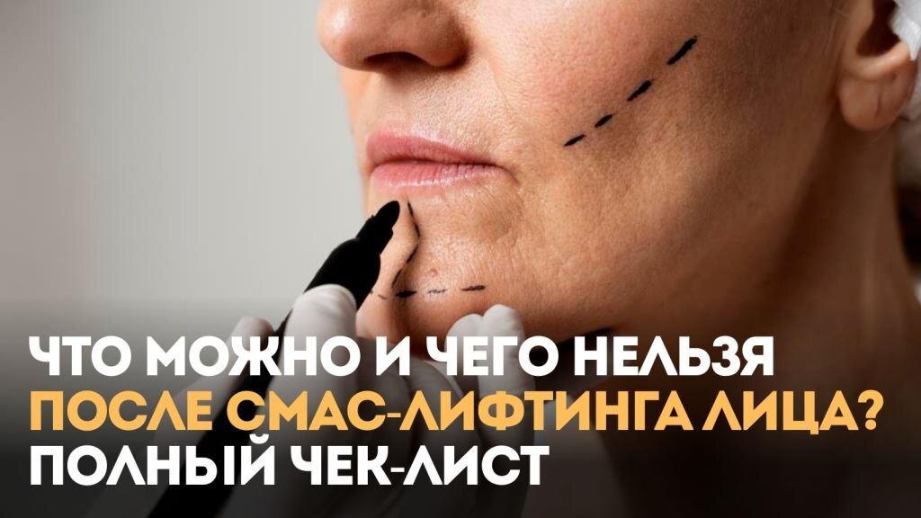 Что можно и чего нельзя после СМАС-лифтинга лица Полный чек-лист