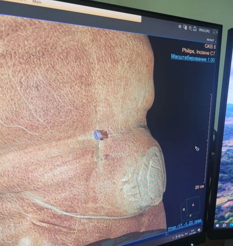    Фото: БСМП № 8