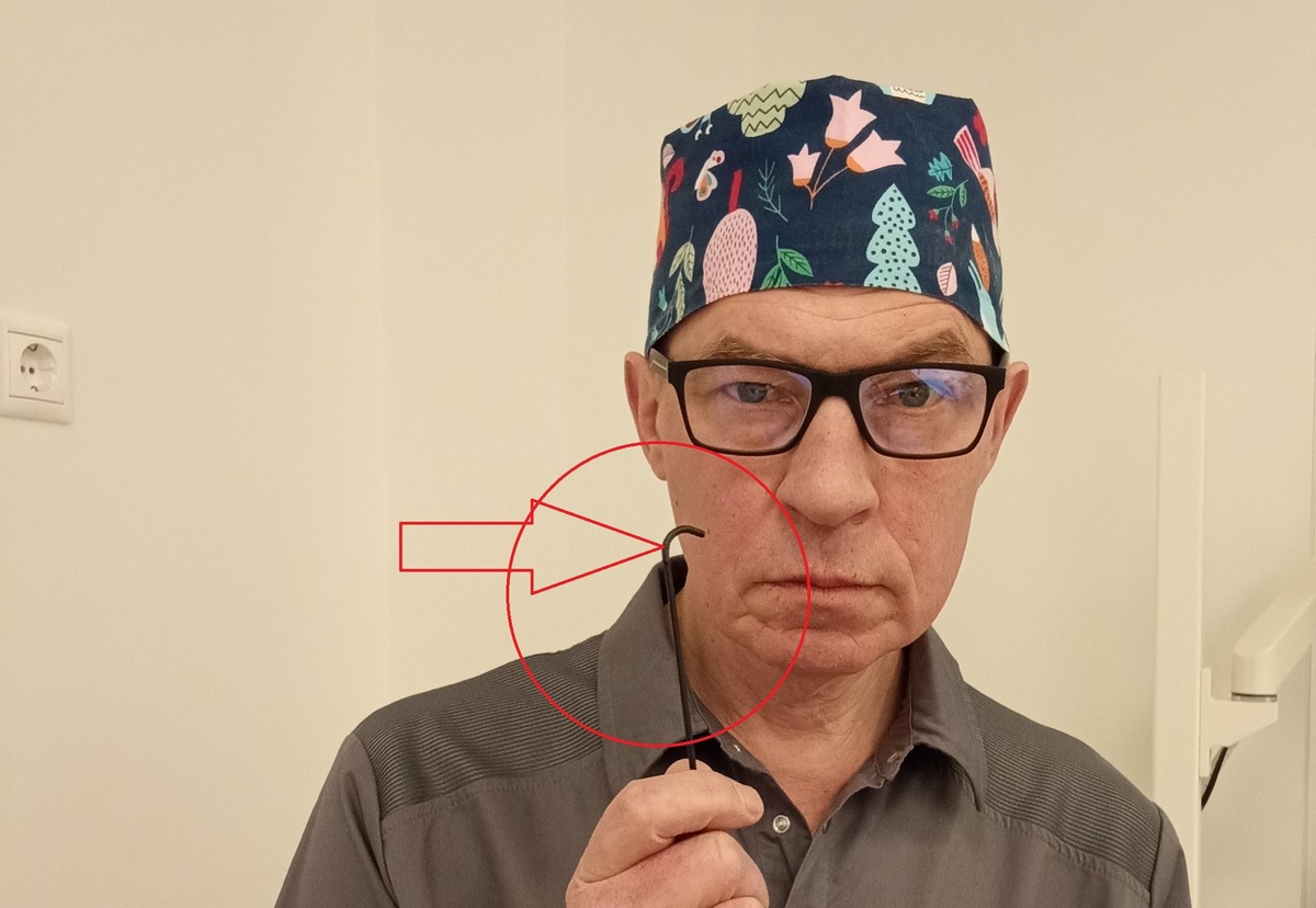 Готово: аденоиды занимают все поле зрения. Именно тут вам настоятельно порекомендуют операцию