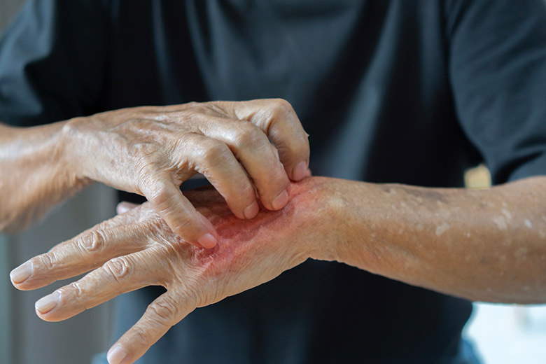    Shutterstock/FOTODOM