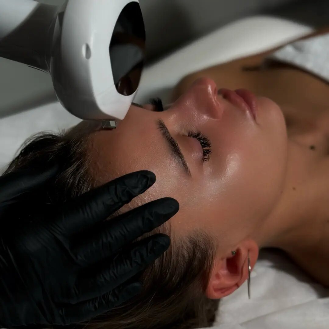 Процедура фотоомоложения в клинике косметологии Uniqderm