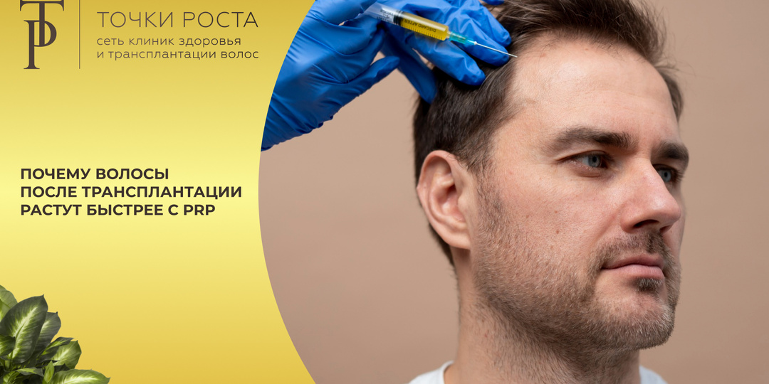 Почему волосы после трансплантации растут быстрее с PRP