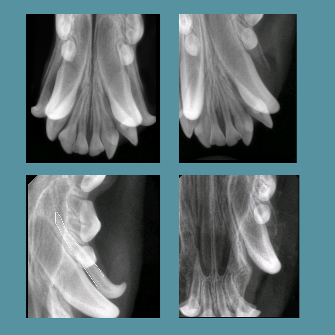 снимки до и после удаления зубов