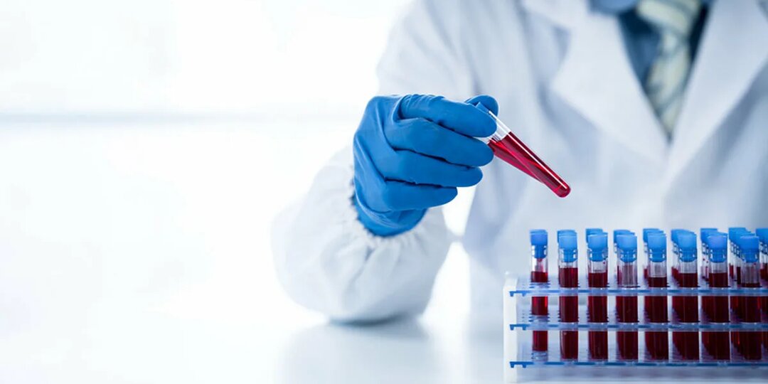 Почему анализы врут: 12 ошибок, которые искажают результаты, и как сдать кровь так, чтобы врач увидел правду