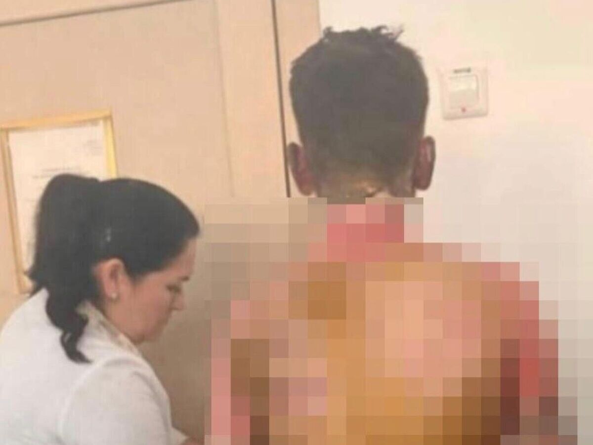    Восьмиклассница подожгла одноклассника в школе №153 Красноярска | © Фото : соцсети