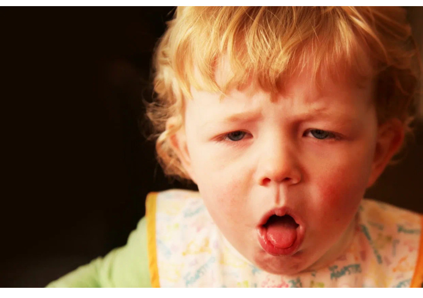 Сильный кашель при коклюше