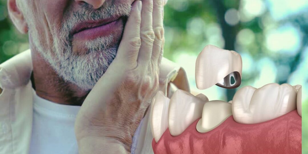 9 вещей, которые стоит знать перед установкой коронок: то, о чём стоматологи не всегда говорят прямо