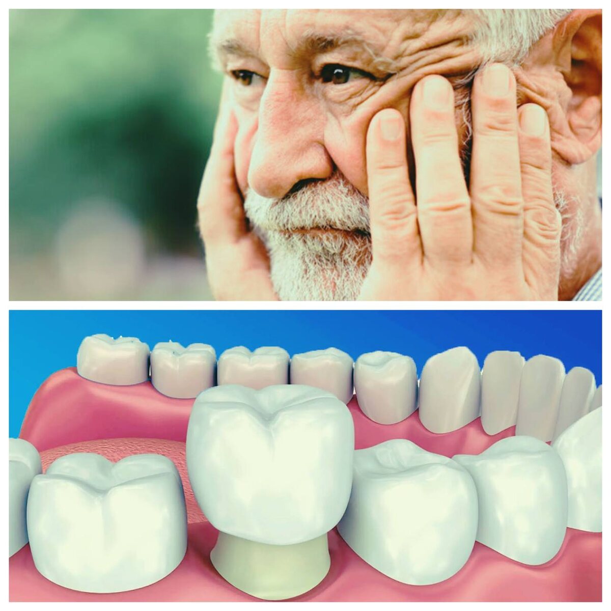 Корононки могут доставить много проблем, особенно если решили сэкономить