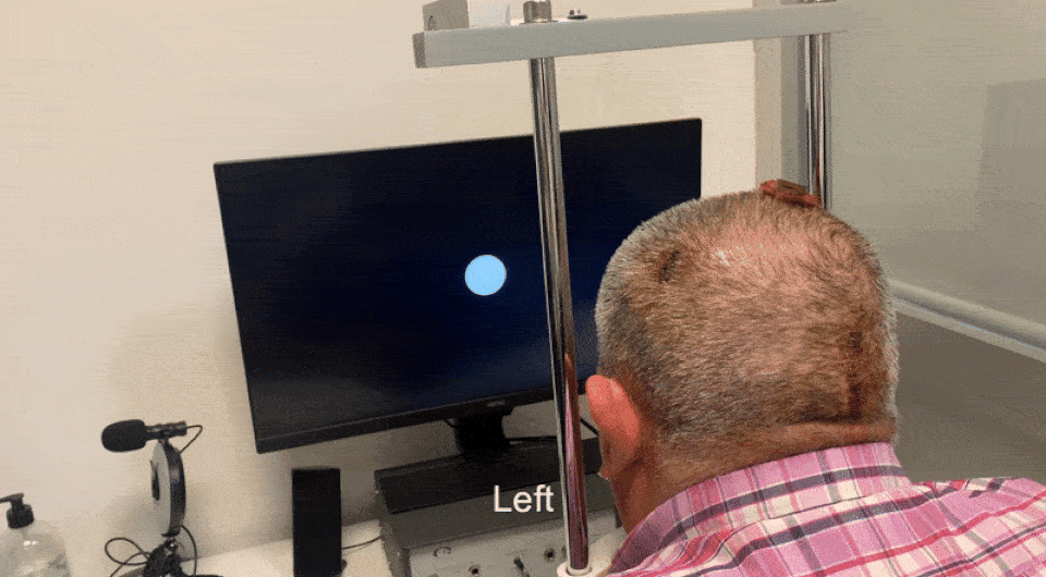   Arantxa Alfaro et al. / Brain Communications, 2026