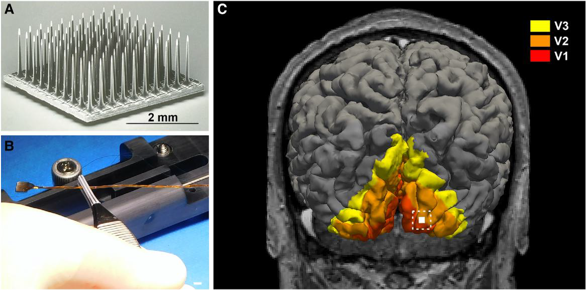   Arantxa Alfaro et al. / Brain Communications, 2026