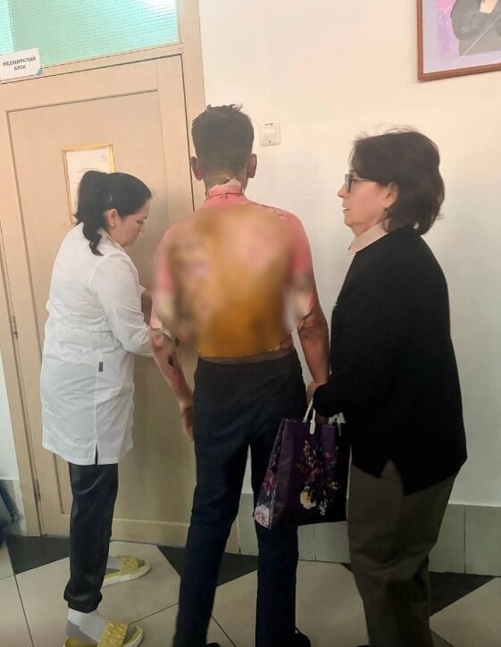    Травмы Фото: Соцсети