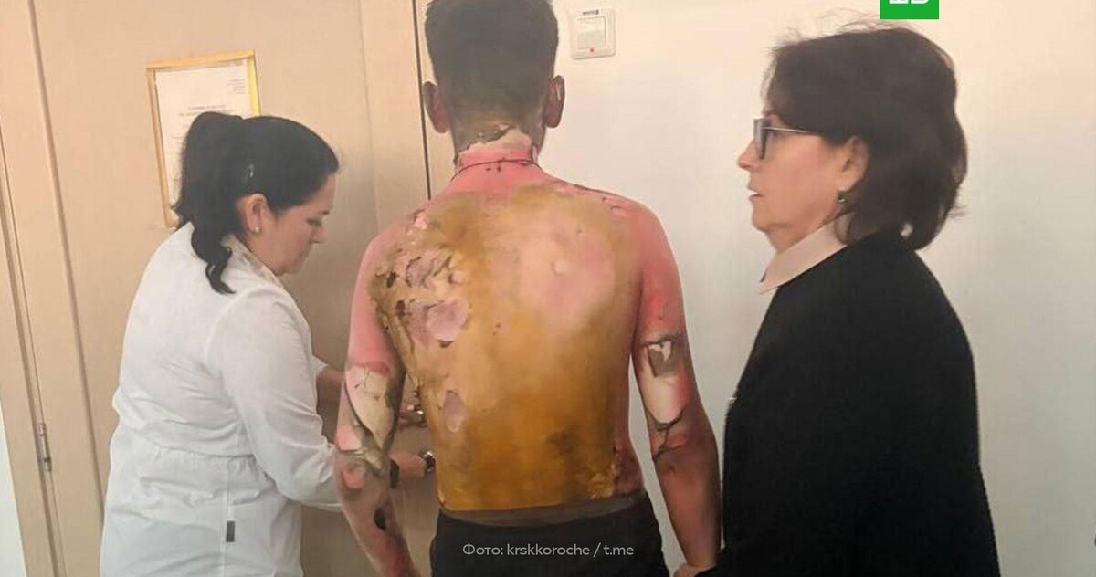 Один из пострадавших мальчиков.