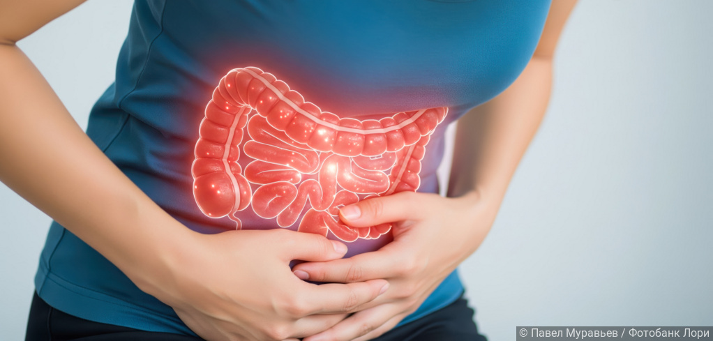 ДНК-анализ полипов толстой кишки показывает скрытые наследственные риски рака