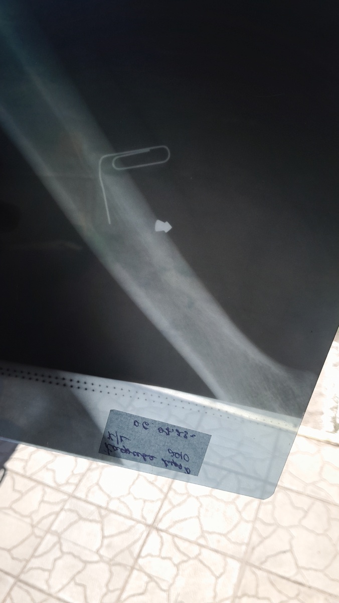 Оказывается, все самые интересные фото (где самая кровь) были удалены((