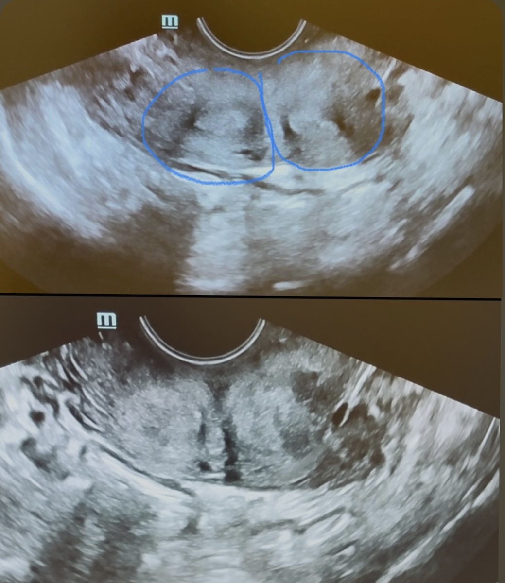 Две матки, поперечный срез. Фото автора.