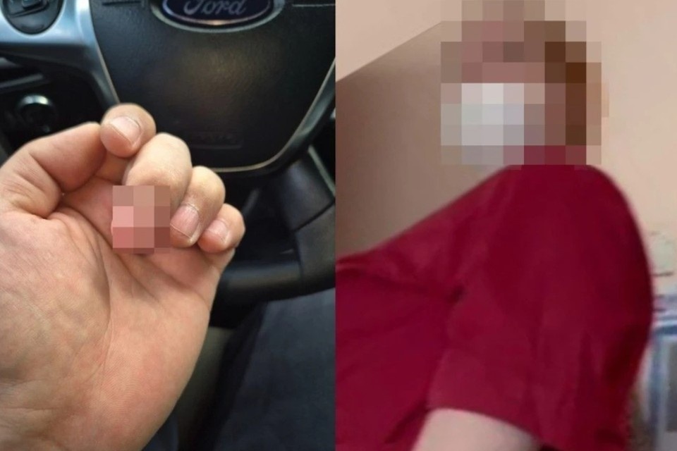 Медсестра нагрубила пациенту, он три часа ждал в очереди и не попал на перевязку пальца. Фото: Предоставлено Станиславом