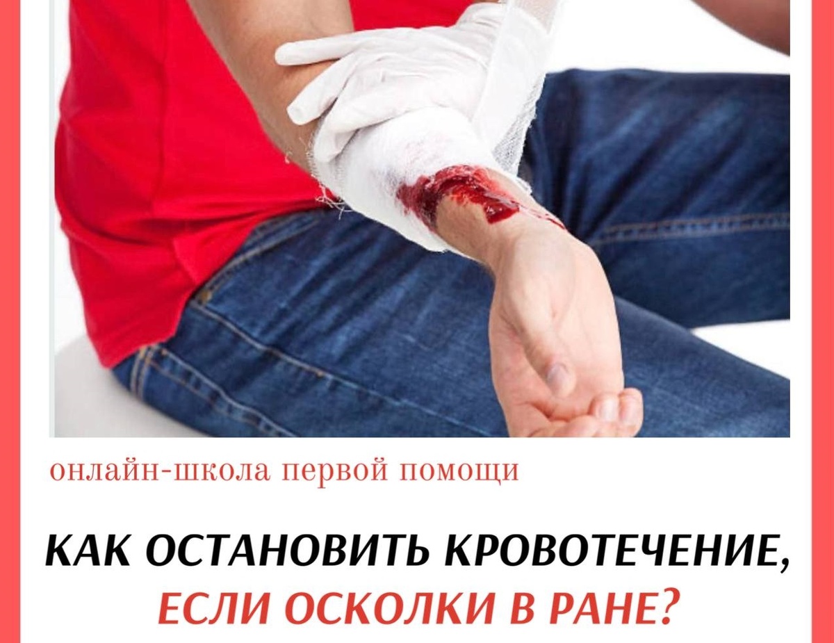 Как остановить кровотечение, если в ране есть осколки?