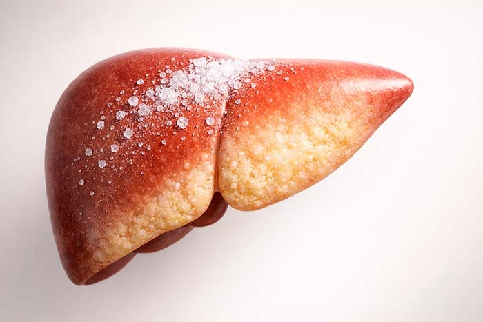 Сахар редко воспринимают как угрозу, потому что он слишком привычный. Но именно он может годами перегружать печень без боли и явных симптомов. Разбираемся, как это работает и что можно изменить без крайностей.