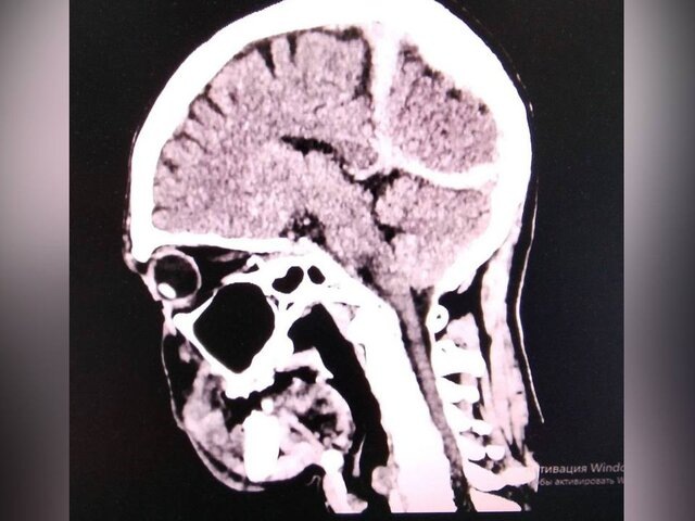    Фото: телеграм-канал "Минздрав Приморья"