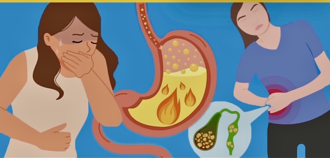 «Сужен проток, густая желчь»: почему врачи так не говорят и что делать на самом деле