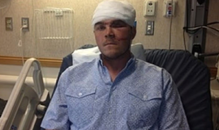     Чейз Деллво. Фото: Mirror.co.uk